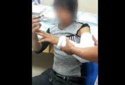 网红吃瓜挨打视频大全集,网红吃瓜挨打视频大盘点